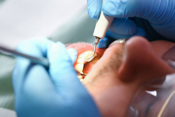 Best Pediatric Emergency Dentist in Santa Rosa, TX